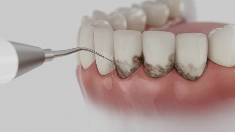 Reliable Dental contractor in Sandy Oaks, TX by Smile Center Dentistry